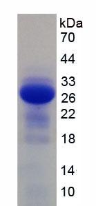 Active Interleukin 2 Receptor Beta (IL2Rb)