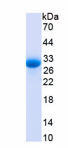 Active Protease, Serine 1 (PRSS1)
