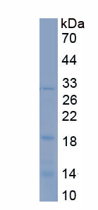 Active Caspase 2 (CASP2)