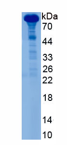 Active Gelsolin (GSN)