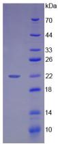 Active High Mobility Group Protein 1 (HMGB1)