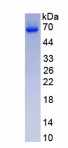 Active High Mobility Group Protein 1 (HMGB1)