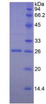 Active Granzyme M (GZMM)