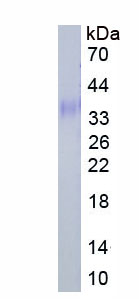 Active Luteinizing Hormone (LH)