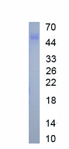 Active Cluster Of Differentiation 55 (CD55)