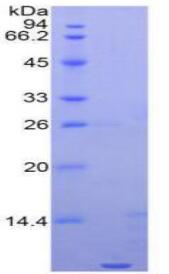 Active N-Terminal Pro-Brain Natriuretic Peptide (NT-ProBNP)