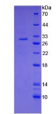 Active Tissue Factor (TF)