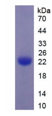 Active Tissue Plasminogen Activator (tPA)