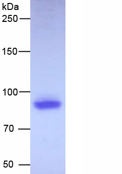 Active Thrombomodulin (TM)