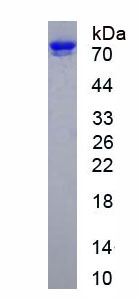 Active Intercellular Adhesion Molecule 1 (ICAM1)