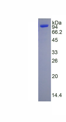 Active Matrix Metalloproteinase 9 (MMP9)