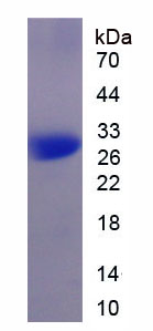 Active Matrix Metalloproteinase 9 (MMP9)