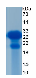 Active Interleukin 1 Beta (IL1b)