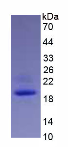 Active Interleukin 1 Beta (IL1b)