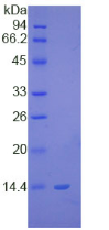 Active S100 Calcium Binding Protein B (S100B)