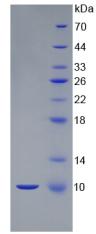 Active S100 Calcium Binding Protein B (S100B)