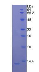 Active S100 Calcium Binding Protein B (S100B)