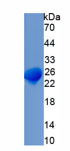 Active Thrombospondin 1 (THBS1)