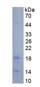 Active Caspase 3 (CASP3)