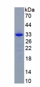 Active Caspase 3 (CASP3)