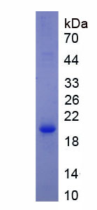 Active Calmodulin (CAM)