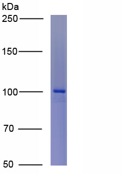 Active Amiloride Binding Protein 1 (ABP1)