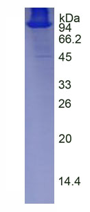 Active Amiloride Binding Protein 1 (ABP1)