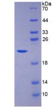 Active Interleukin 7 (IL7)