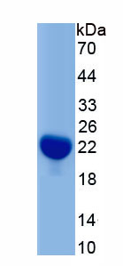 Active CCAAT/Enhancer Binding Protein Gamma (CEBPg)