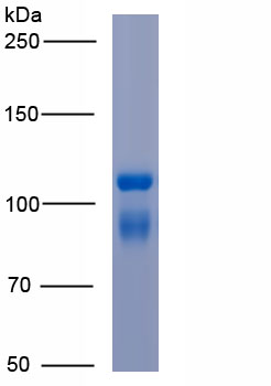 Active Coagulation Factor XII (F12)