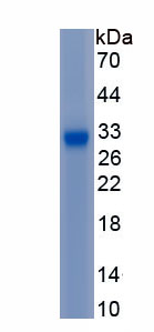 Active Protein Kinase, AMP Activated Alpha 1 (AMPK Alpha 1)