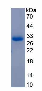 Active Mucin 5 Subtype B (MUC5B)