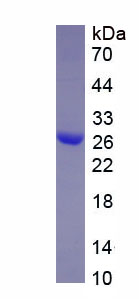 Active Calretinin (CR)