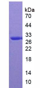 Active Carbonic Anhydrase II (CA2)