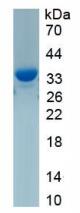 Active Carbonic Anhydrase II (CA2)