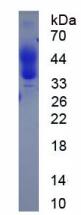 Active Programmed Cell Death Protein 1 Ligand 2 (PDL2)