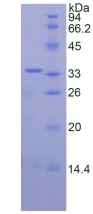 Active Pregnancy Associated Plasma Protein A (PAPPA)