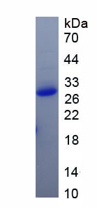 Active C Reactive Protein (CRP)