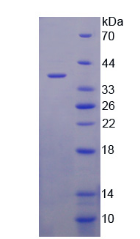 Active Lipoprotein, a (Lpa)