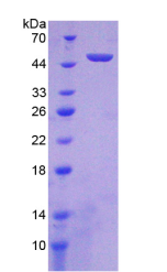 Active Receptor Activator Of Nuclear Factor Kappa B Ligand (RANkL)