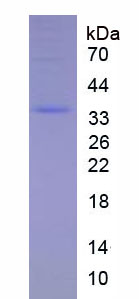 Active Receptor Activator Of Nuclear Factor Kappa B Ligand (RANkL)