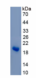 Active Receptor Activator Of Nuclear Factor Kappa B Ligand (RANkL)