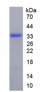 Active Receptor Activator Of Nuclear Factor Kappa B Ligand (RANkL)