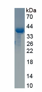 Active Neuropeptide Y (NPY)