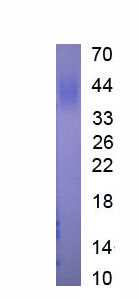 Active Cluster Of Differentiation 200 (CD200)