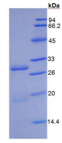 Active Cluster Of Differentiation 26 (CD26)