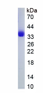 Active Pulmonary Surfactant Associated Protein A1 (SFTPA1)