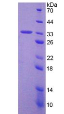 Active Tumor Protein p53 (P53)