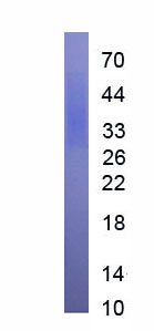 Active Tubulin Polymerization Promoting Protein (TPPP)