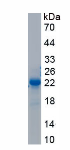 Active Acid Phosphatase 1 (ACP1)